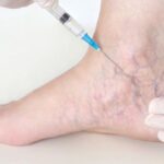 ഇടയ്ക്കിടെ കൈ കുലുക്കാറുണ്ടോ? ഡൊണാള്‍ഡ് ട്രംപിന് നീര്‍വീക്കത്തിനു കാരണമാകുന്ന രോഗം