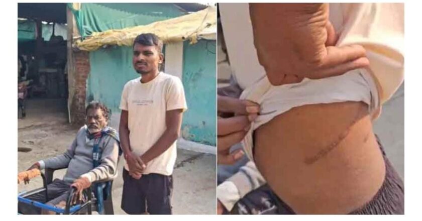 മഹാരാഷ്ട്രയിൽ ക്രൂരത: കടം വീട്ടാൻ പലിശക്കാരുടെ ഭീഷണിയെത്തുടർന്ന് കർഷകന് വൃക്ക വിൽക്കേണ്ടി വന്നു